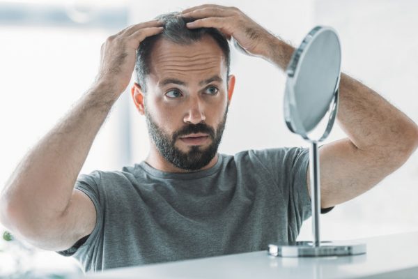 Príčiny vypadávania vlasov u mužov